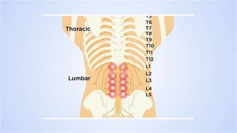 How DRG stimulation at T12 reveals the transmission of low back pain in the spinal cord: The ...