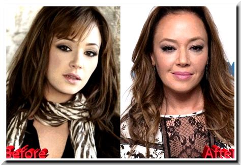 Leah Remini Plastic Surgery Scandals – Natural Bra Size or Botox ...