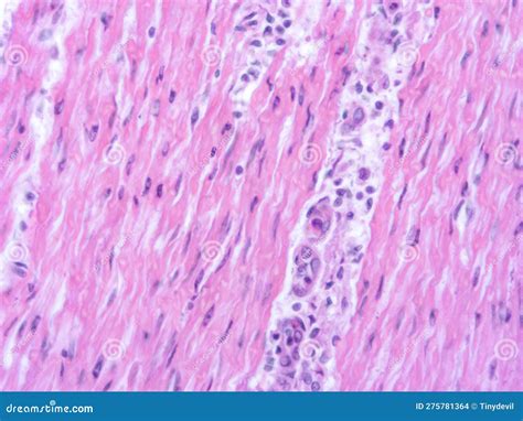 Picture of Histology Human Tissue with Microscope from Laboratory (not ...