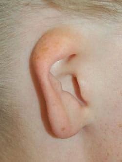 Congenital Ear Malformation Services | MUSC Health | Charleston SC