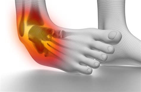 Acute Injuries - Chicago Health & Wellness