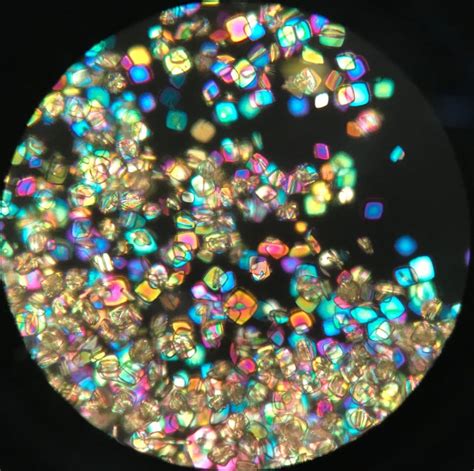 Urine Sediment of the Month Series - Renal Fellow Network