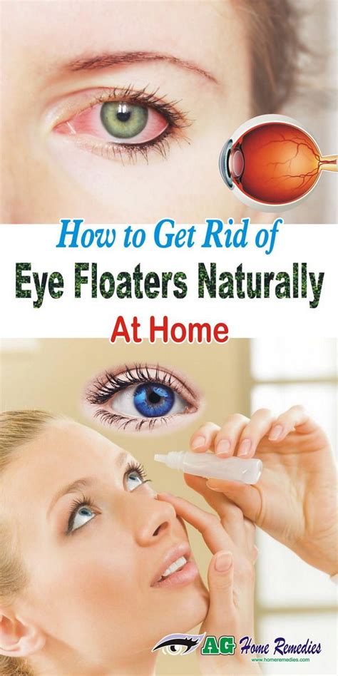 How to Get Rid Of Eye Floaters Naturally At Home | Eye floaters cure, Eye health, Natural health ...