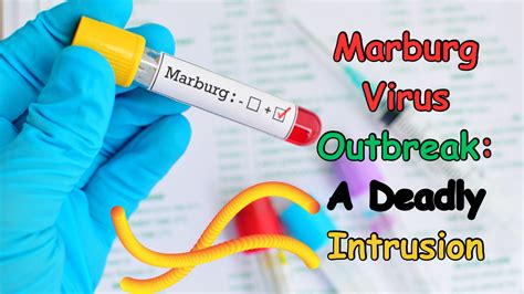 2023 Marburg Virus Outbreak: A Deadly Intrusion - Empty Bucket Head