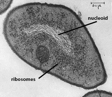 Ribosomes Electron Micrograph