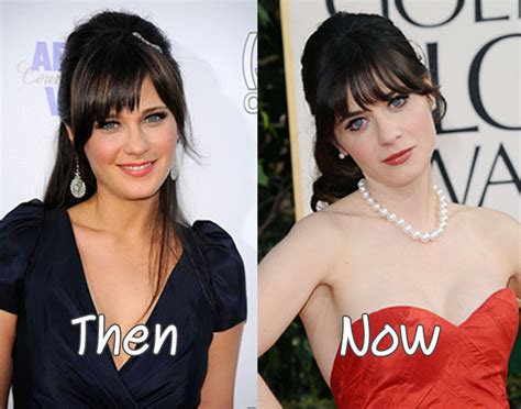 Zooey Deschanel Plastic Surgery Before And After Nose Job Photos