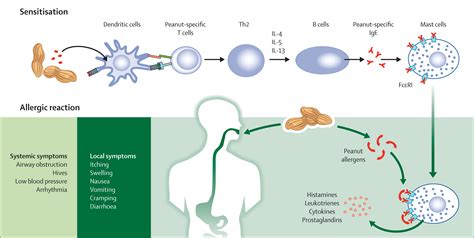 References in Peanut allergy - The Lancet