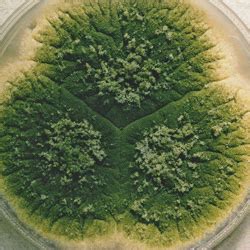 Aspergillus Flavus - Symptoms, Disease, & Treatment | Mold Busters