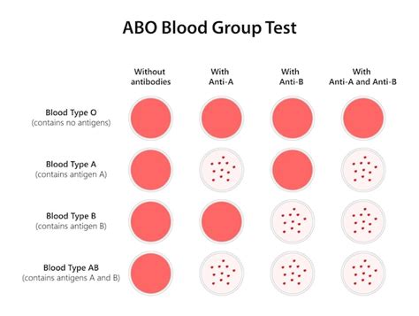 Premium Vector | Abo blood group test