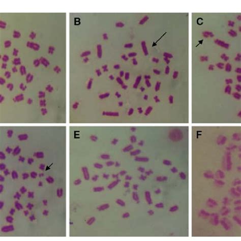 Photomicrographs showing structural chromosome aberrations observed in ...