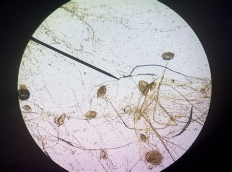 Rhizopus Stolonifer Under Microscope