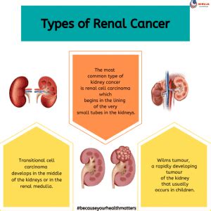 Types of Renal Cancer