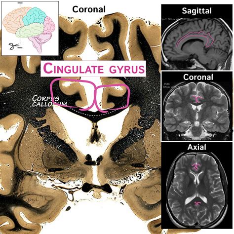 Cingulate Gyrus Anatomy