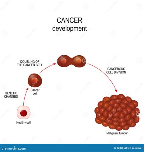 Cancercell Utveckling För Sjukdom För Illustrationvisningcancer Vektor Illustrationer ...