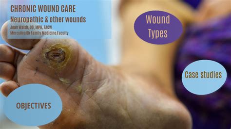 Neuropathic ulcers and miscellaneous wounds by jean walsh on Prezi