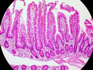 Duodenum Jejunum Ileum Histology