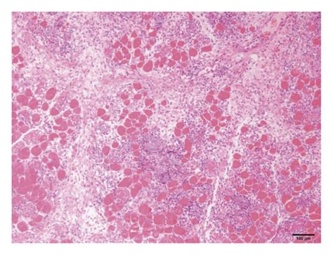 Histological investigation of the tissue necrosis. (a) A group; (b) B ...