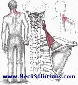 Stiff Neck Pain - Causes & Treatment