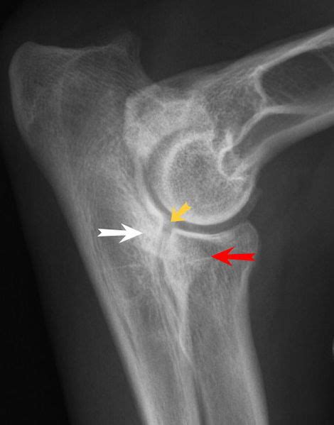 The Trouble With Elbow Dysplasia - Animalso