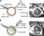 Frontiers | Intravitreal AAV-Delivery of Genetically Encoded Sensors ...