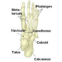 Tarsal Fracture | Broken Foot