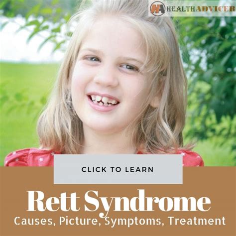 Rett Syndrome Hands