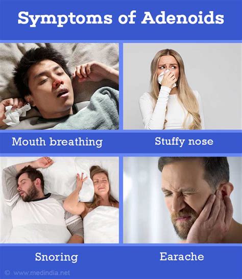 Adenoids