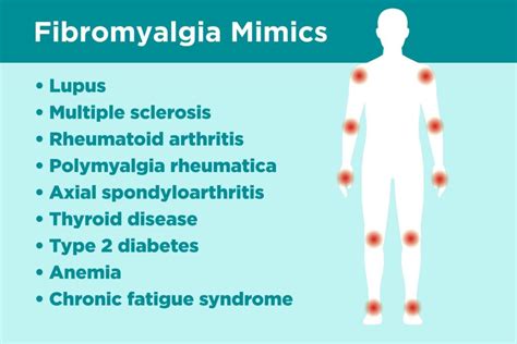 Fibromyalgia Misdiagnosis: Diseases Fibromyalgia Can Be Mistaken For