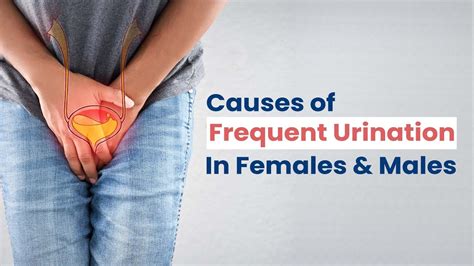 What Causes Frequent Urination? | Frequent Urination Causes in Females & Males | MFine - YouTube