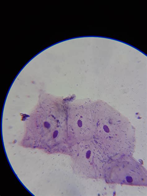 [OC] A group of cheek cells stained with wrights and giemsa stain. Bacteria is also present ...