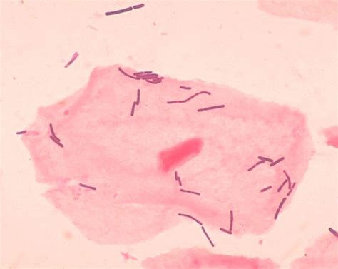 Lactobacillus - wikidoc