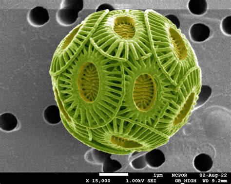 SEM/TEM/EPMA | Image Contest Grand Prize Winners | 2023