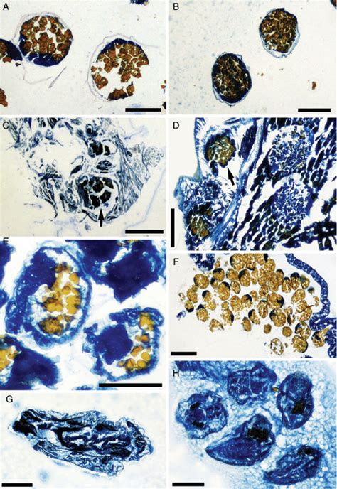 Histology of host eggs, barnacle guts, and barnacle eggs (A, C, voucher... | Download Scientific ...