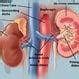 Kidney Stone Causes, First Signs, Symptoms, Treatment, Surgery