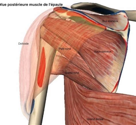 La tendinite de la coiffe des rotateurs ou tendinite de l'épaule, par l'Unité de chirurgie de l ...