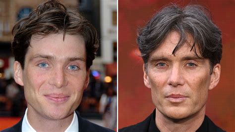 Cillian Murphy Plastic Surgery: Transformation Photos | Life & Style