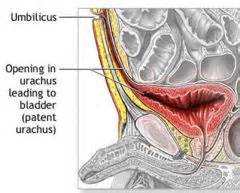 Block 4 MD 1 Embryology urogenital part F Dz-s Flashcards - Cram.com