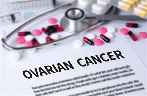 Treatment Approaches Evolving in Recurrent Ovarian Cancer | Hysterectomy