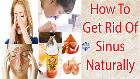 Simple And Natural Home Remedies Fight Sinus Infection | How To Get Rid Of Sinus Naturally - YouTube