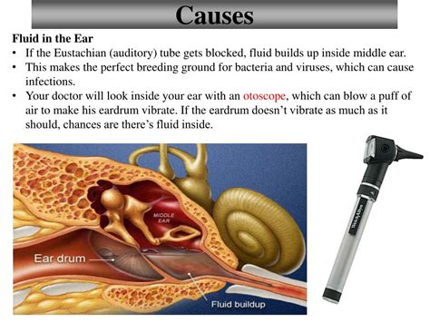 PPT - Sponge: Set up Cornell Notes on pg. 59 Topic: 12.5: Middle Ear ...