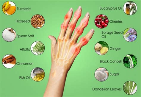 Pin by Kathie Jepson-Bernier on Health | Rheumatoid arthritis diet, Home remedies for arthritis ...