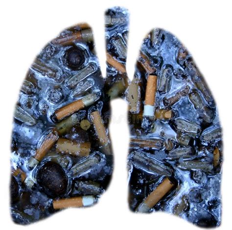 Smokers lungs stock photo. Image of effects, stop, anatomy - 945380