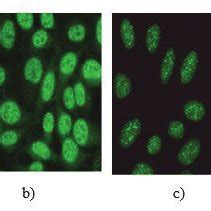 a) Homogeneous b) Speckled c) Centromere and d) Nucleolar ANA IFA... | Download Scientific Diagram