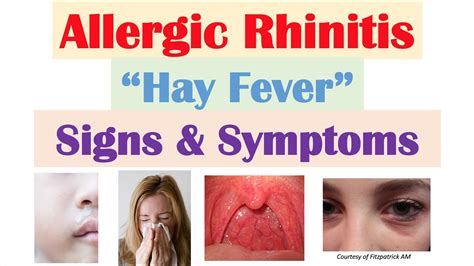 Does hay fever mean you have a weak immune system? : pandoratopのblog