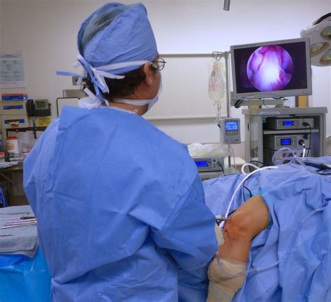 Arthroscopy - OrthoInfo - AAOS