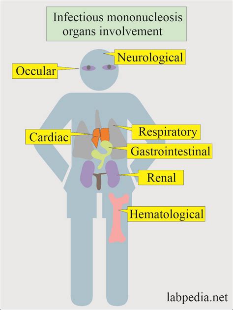 Epstein-Barr virus (EBV) and Infectious mononucleosis