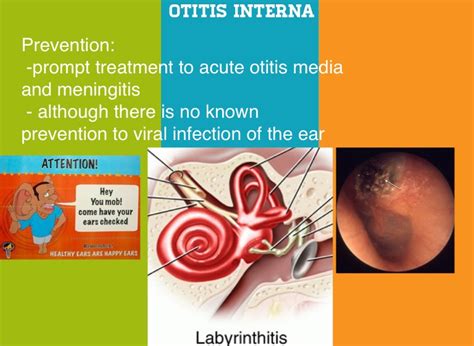 Otitis - Screen 8 on FlowVella - Presentation Software for Mac iPad and iPhone