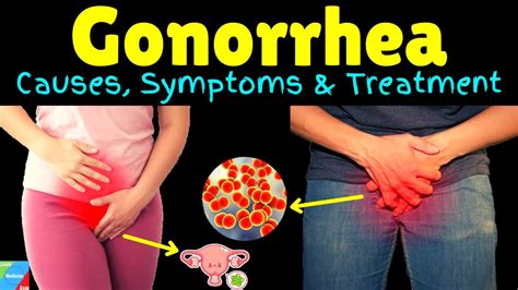 Gonorrhea In Men Symptoms And Treatment