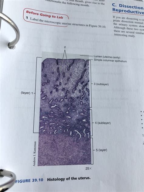 39.10- Histology of the Uterus Diagram | Quizlet