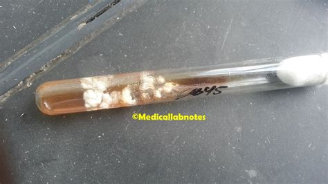 Fusarium oxysporum: Introduction, Morphology, Pathogenicity, Lab